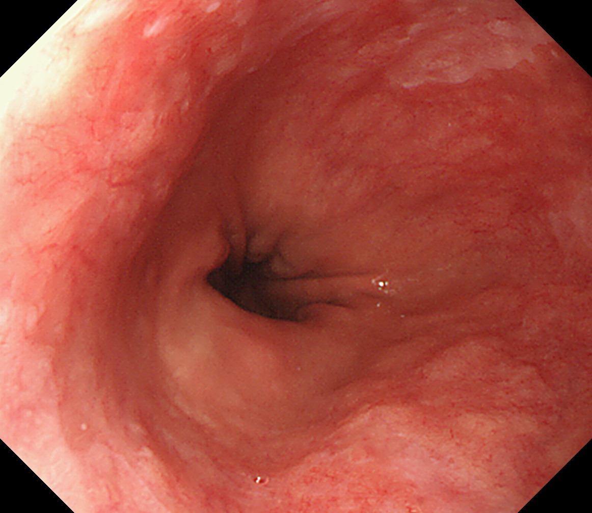 �̉������